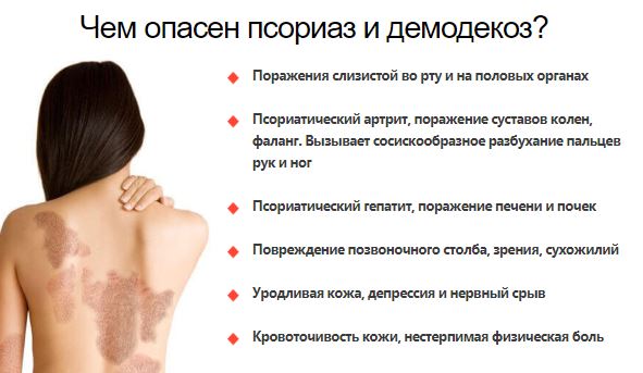 Как заказать псорисил купить в Новомосковске